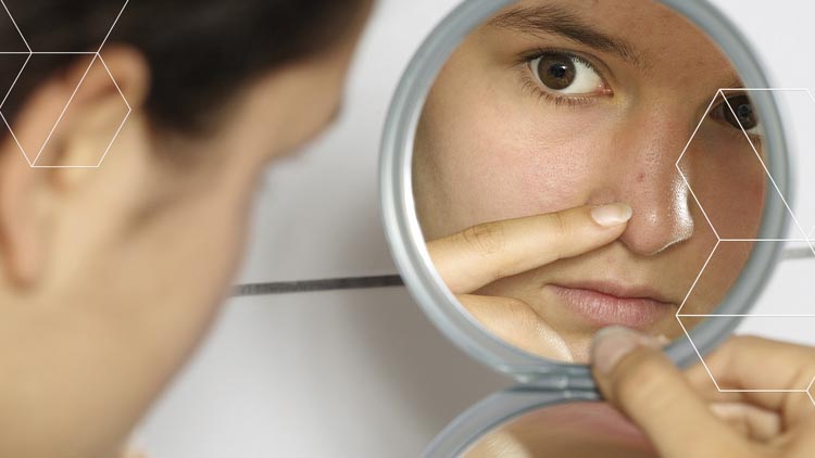 Acne and Skin Treatment in Mandi Adampur